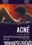 poster del film Acné