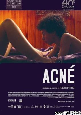 Affiche de film Acné