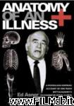 poster del film Anatomy of an Illness [filmTV]